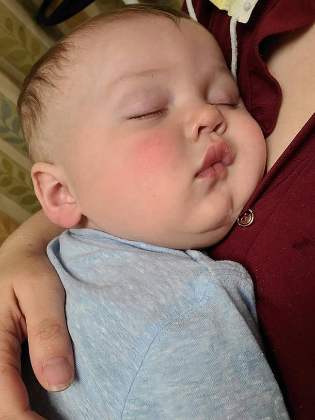 Bé trai 7 tháng tuổi sốt đến 40 độ C chỉ trong vòng vài giờ sau khi có triệu chứng viêm đường hô hấp - Ảnh 1.