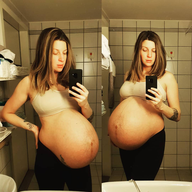 Hình ảnh bụng bầu mang thai đôi, thai ba là minh chứng cho thấy mẹ đã mạnh mẽ như thế nào, khiến nhiều ai nhìn thôi cũng thấy xót xa - Ảnh 1.