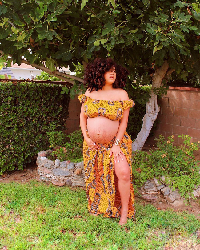 Hình ảnh bụng bầu mang thai đôi, thai ba là minh chứng cho thấy mẹ đã mạnh mẽ như thế nào, khiến nhiều ai nhìn thôi cũng thấy xót xa - Ảnh 2.