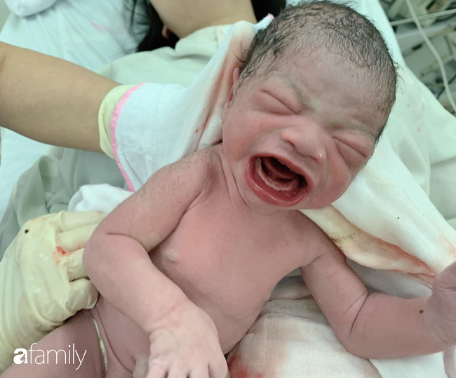 Bức ảnh chào đời ấn tượng của em bé Lào Cai: Mở miệng rộng hết cỡ để khóc làm bác sĩ cũng phải giật mình - Ảnh 1.