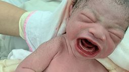 Bức ảnh chào đời ấn tượng của em bé Lào Cai: Mở miệng rộng hết cỡ để khóc làm bác sĩ cũng phải giật mình