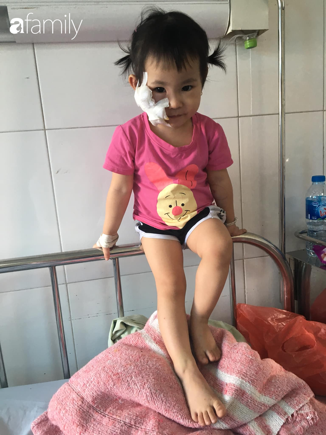 Bé 2 tuổi rưỡi ở Bắc Ninh bị chó nhà tấn công, bố mẹ đừng chủ quan nghĩ rằng 