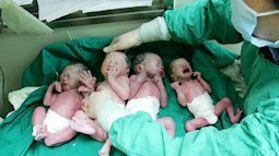 Những hình ảnh hiện tại của cặp sinh 4 tự nhiên cực hiếm gặp, có em bé lúc chào đời nặng chưa đầy 1kg