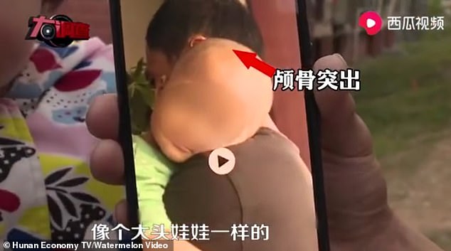 Trẻ em Trung Quốc đột nhiên mắc bệnh 