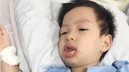 Từng nghĩ răng sữa sâu không sao, rồi sẽ thay, mẹ Hà Nội đã hối hận khi con trai phải gây mê suốt 6 tiếng để điều trị răng sâu