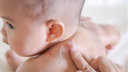 Dị ứng thời tiết ở trẻ sơ sinh - Dấu hiệu nhận biết và cách chăm sóc