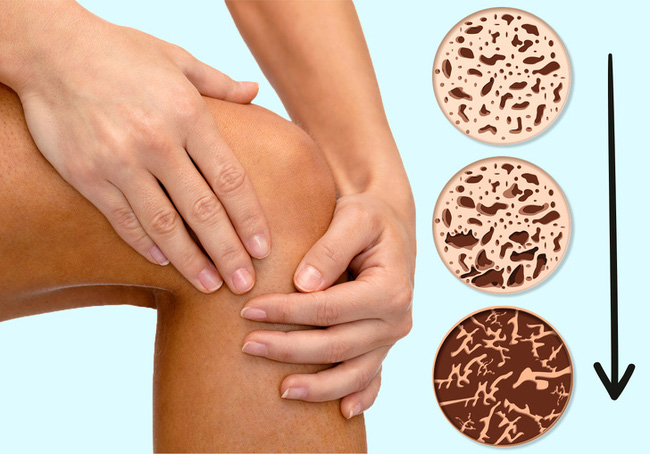 Ngoài mất kinh và luôn bốc hỏa, chị em dù còn trẻ cũng đừng bỏ qua dấu hiệu Ngoài mất kinh và luôn bốc hỏa, chị em dù còn trẻ cũng đừng bỏ qua dấu hiệu