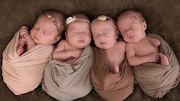 4 bé gái trong ca sinh tư giống hệt nhau vô cùng hiếm trên thế giới với tỷ lệ chỉ 1/70 triệu ca sau 3 năm đã có những thay đổi gây ngỡ ngàng