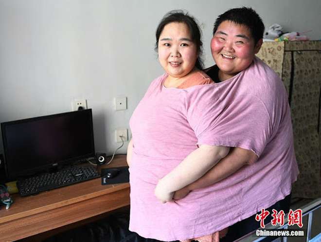 Chuyện lạ ở Tứ Xuyên: Kết duyên vì muốn cùng nhau giảm cân, nào ngờ sau vài năm hai vợ chồng đều nặng gần 200kg - Ảnh 2.