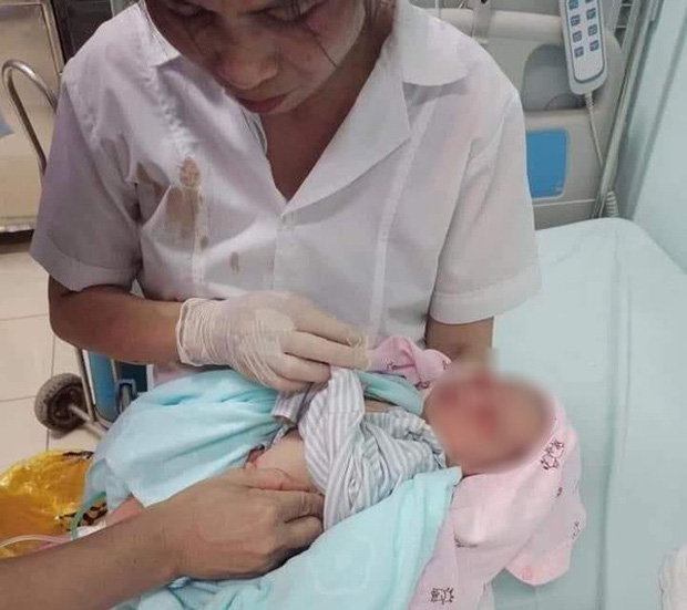 Hà Nội: Bé sơ sinh bị bỏ rơi 3 ngày dưới hố gas trong nắng nóng 40 độ, kiến giòi bu khắp người - Ảnh 1.