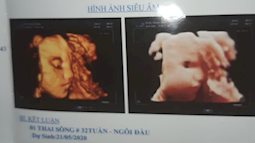Siêu âm thai nhẹ cân, mẹ trẻ chủ quan không ăn uống tẩm bổ, con chào đời chỉ sống được 1 tuần