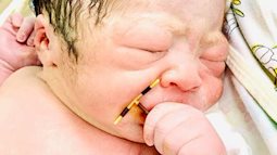 Bé sơ sinh ở Hải Phòng gây sốt khi chào đời với chiếc vòng tránh thai trong tay