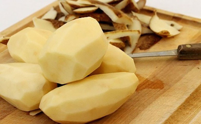 Những lưu ý khi ăn khoai tây để không gây hại cho sức khoẻ - Ảnh 7.