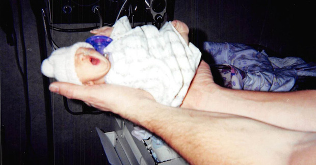 Cô bé tí hon sinh ra nằm lọt thỏm trong lòng bàn tay, bị chẩn đoán chỉ sống vài ngày nhưng 12 năm sau lại khiến thế giới kinh ngạc - Ảnh 1.