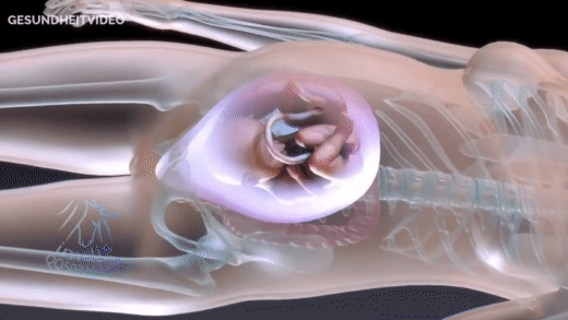 Đoạn clip mô phỏng quá trình sinh mổ: nhìn thôi cũng thấy đau - Ảnh 2.