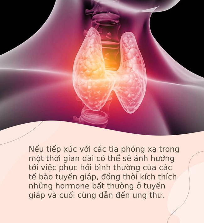 Đây là 4 kiểu người có nguy cơ cao mắc ung thư tuyến giáp nhất: Nếu cũng thuộc nhóm người này, bạn nên đi khám càng sớm càng tốt - Ảnh 3.