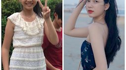 Màn "dậy thì" hot nhất Hoa hậu Việt Nam 2020: Cô nàng từng nhận đủ combo khuyết điểm lột xác nhờ... niềng răng