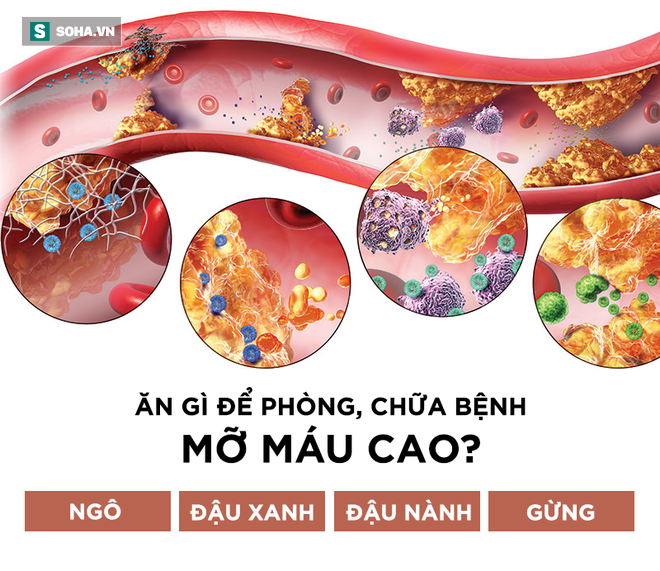 Cách đơn giản để xác định có bị mỡ máu hay không: Đừng bỏ qua mà nguy hiểm tính mạng - Ảnh 4.