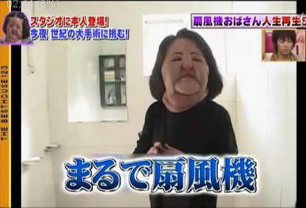 Xót xa thảm hoạ dao kéo Han Mi Ok: Mỹ nhân biến dạng vì nghiện thẩm mỹ, mua dầu ăn về tự tiêm và cái chết bí ẩn tuổi 57 - Ảnh 9.