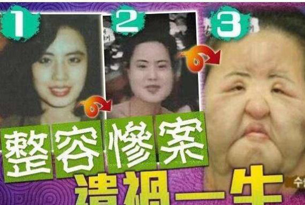 Xót xa thảm hoạ dao kéo Han Mi Ok: Mỹ nhân biến dạng vì nghiện thẩm mỹ, mua dầu ăn về tự tiêm và cái chết bí ẩn tuổi 57 - Ảnh 8.