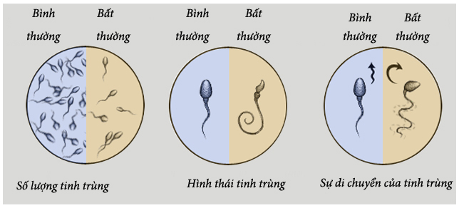 Nam giới thường xuyên làm việc này vào ban đêm thì chất lượng tinh trùng kém đi trông thấy, không thay đổi ngay thì có thể dẫn đến vô sinh - Ảnh 2.