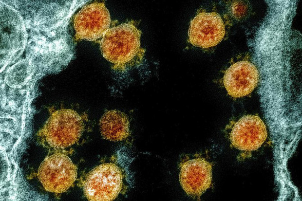 Virus SARS-CoV-2 tồn tại trên da người trong 9 giờ đồng hồ - Ảnh 1.