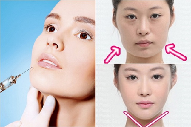 Người phụ nữ  nhập viện khi tiêm botox làm đẹp tại cơ sở spa - Ảnh 1.