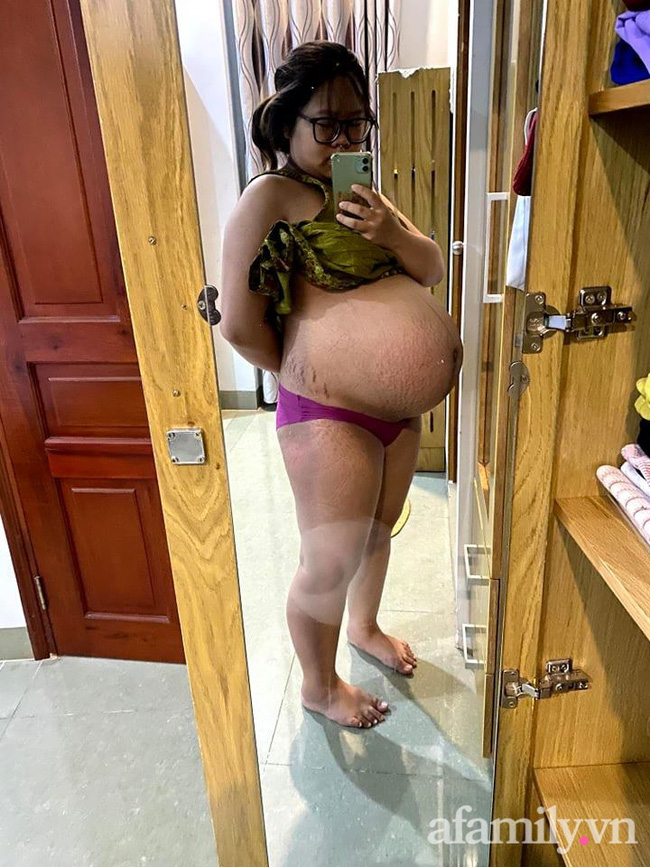 Mẹ 9x mang thai tăng 40kg, còn hứng đủ combo thâm, hôi nách khiến ngoại hình 