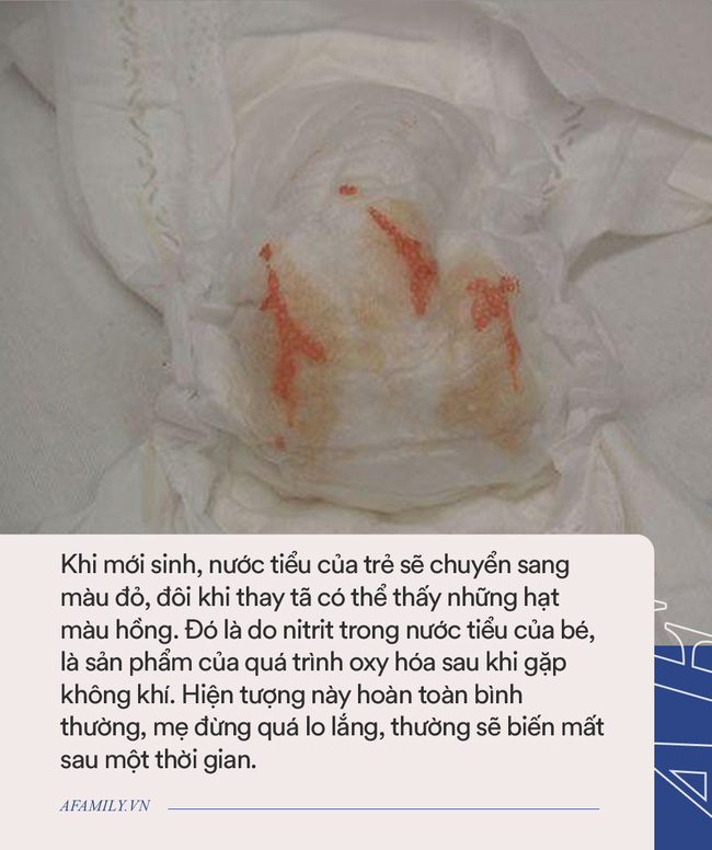 Những hiện tượng sinh lý đặc biệt này ở trẻ sơ sinh khiến cha mẹ lo sợ, nhưng chúng là bình thường - Ảnh 3.