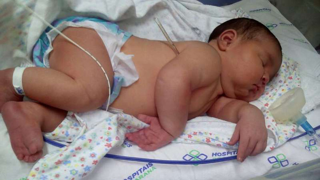 Một bà mẹ đã làm nên kỳ tích khi hạ sinh thành công con gái nặng cân nhất bệnh viện, dù chỉ tăng 11kg trong suốt thai kỳ - Ảnh 1.
