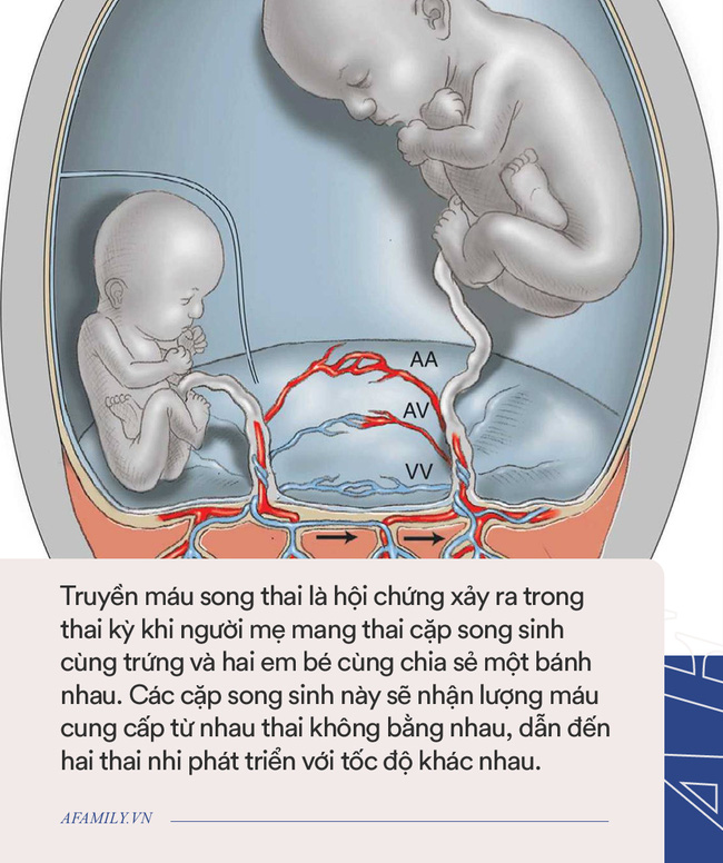 Lần đầu tiên gặp nhau sau 200 ngày xa cách, cặp chị em song sinh đã có hành động khiến nhiều người xúc động  - Ảnh 2.