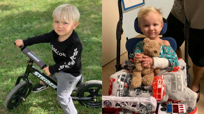 Bé trai 3 tuổi bị cắt bỏ hai chân và vài ngón tay sau cú ngã xe đạp - Ảnh 3.