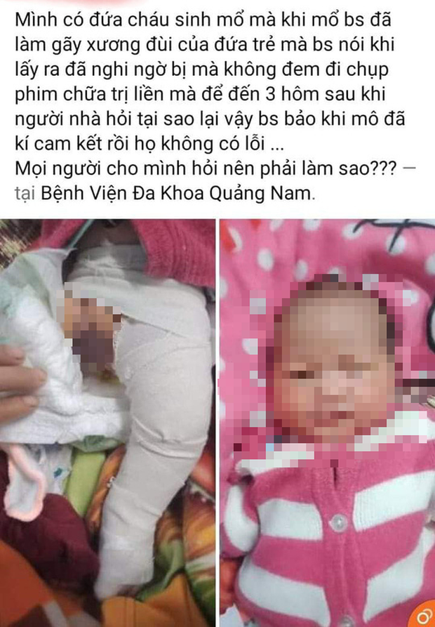 Bệnh viện Đa khoa Quảng Nam báo cáo việc bé trai gãy chân khi sinh mổ - Ảnh 3.