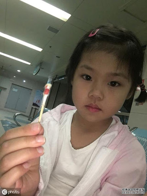 Bé gái 3 tuổi bị dính âm hộ nặng, nguyên nhân xuất phát từ sự vệ sinh sai cách của người mẹ - Ảnh 2.