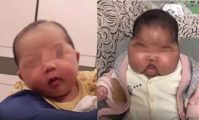 Sự cố “em bé đầu to” chấn động Trung Quốc, hàng loạt kem dưỡng da em bé bị thu hồi khiến phụ huynh hoang mang - Ảnh 1.
