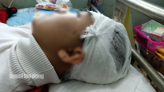  Sở GD-ĐT Thanh Hóa yêu cầu làm rõ trách nhiệm trong vụ nam sinh bị đánh vỡ sọ não  - Ảnh 1.