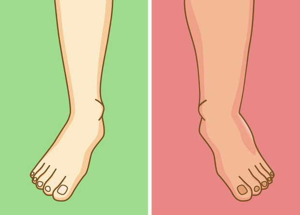 Thường xuyên ngồi vắt chéo chân, bạn sẽ dễ gặp phải 5 vấn đề sức khỏe gây ảnh hưởng từ chân lên đến đầu - Ảnh 5.