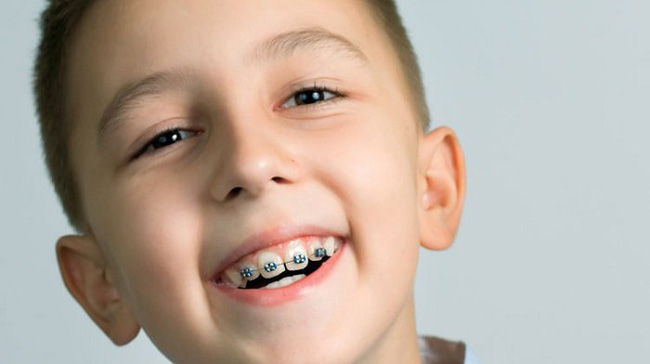Những bệnh răng miệng ở trẻ em cần phải xử lý trước năm 12 tuổi,  nếu không sẽ ảnh hưởng đến diện mạo cả đời của trẻ - Ảnh 2.