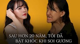 Màn "lột xác" ngoạn mục của cô gái có gương mặt dị dạng: Hơn 20 năm mới tự tin soi gương