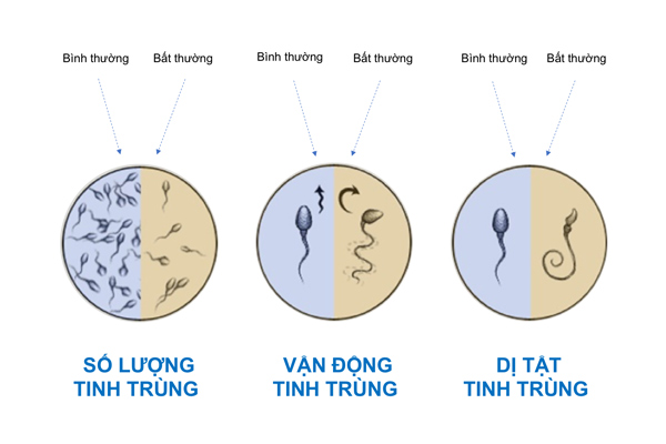 Tỉ lệ vô sinh ở nam giới ngày càng tăng, người đàn ông có 6 đặc điểm này chứng tỏ có nhiều khả năng sinh sản tốt - Ảnh 3.