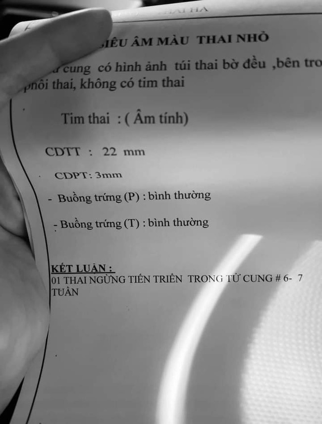 Nữ ca sĩ Việt mang thai lần 4, đau xót khi siêu âm 5 lần vẫn không thấy tim thai: 