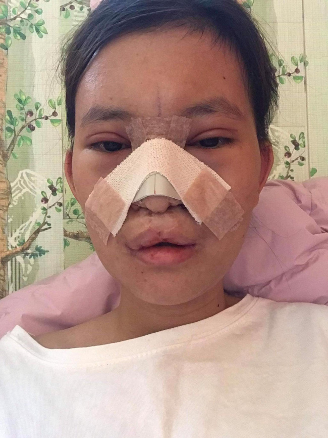 18 năm mặc cảm vì dị tật sứt môi, nữ sinh 2K1 lên đường sang Hàn Quốc làm 5 cuộc phẫu thuật và ngoại hình mới đốn tim cộng đồng mạng - Ảnh 3.