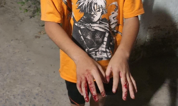 TP.HCM: Hé lộ nguyên nhân bé trai bị cha đánh bằng cây tre khiến dư luận phẫn nộ - Ảnh 1.