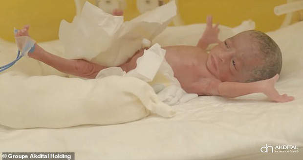 Hình ảnh mới nhất của các em bé trong ca sinh 9 hy hữu gây chấn động thế giới gần đây - Ảnh 5.