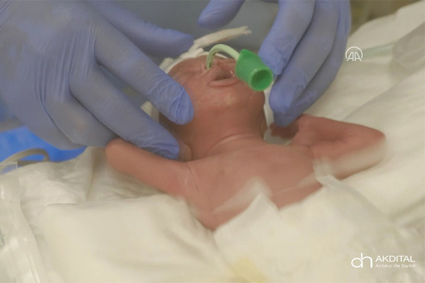 Hình ảnh mới nhất của các em bé trong ca sinh 9 hy hữu gây chấn động thế giới gần đây - Ảnh 6.