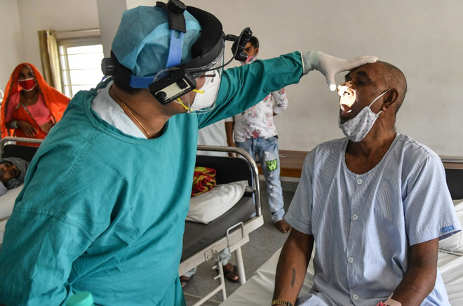 Dịch bệnh chết chóc mới khiến Ấn Độ gục ngã: 60% bệnh nhân phải cắt bỏ một phần khuôn mặt - Ảnh 1.