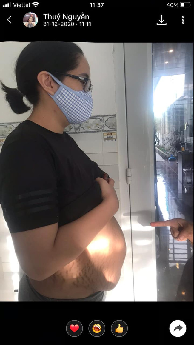 Hoa hậu Đặng Thu Thảo lộ ảnh khi mang thai, nhìn khuôn mặt chi chít mụn không ai có thể nhận ra - Ảnh 2.