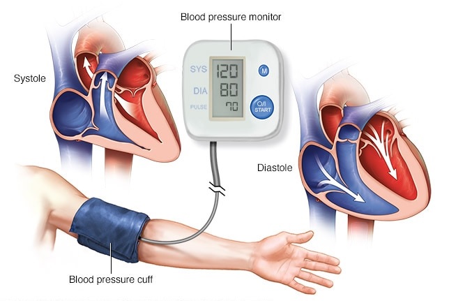 Bệnh nhân tăng huyết áp cần làm gì trong mùa Covid-19 - Ảnh 1.