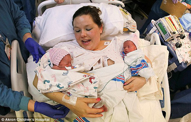 Hai chị em sinh đôi trong bức ảnh vừa lọt lòng mẹ đã nắm chặt tay nhau nổi tiếng khắp thế giới 7 năm trước giờ ra sao? - Ảnh 2.