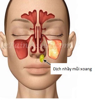 Xui nhau dùng nước muối đậm đặc súc mũi rửa virus SARS-CoV-2, bác sĩ thốt lên: Đừng nghe đồn nhảm mà... rước thêm bệnh! - Ảnh 5.